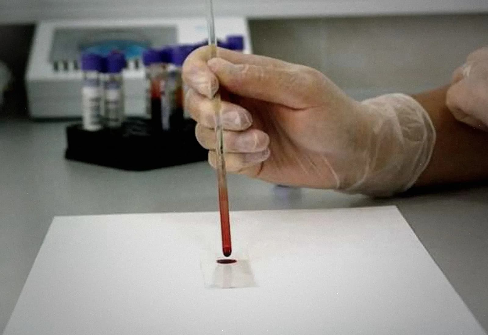 Tödlicher Virus